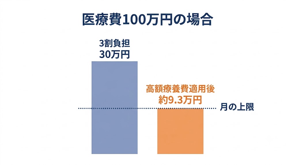 医療費の自己負担は3割負担のさらに上にある月の上限で頭打ちになる図解